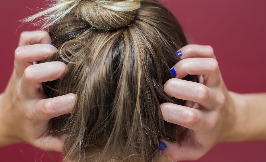 causes of scalp itching